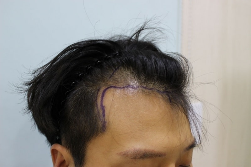 수술전3.jpg