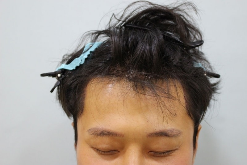 다음날샴푸후1.jpg