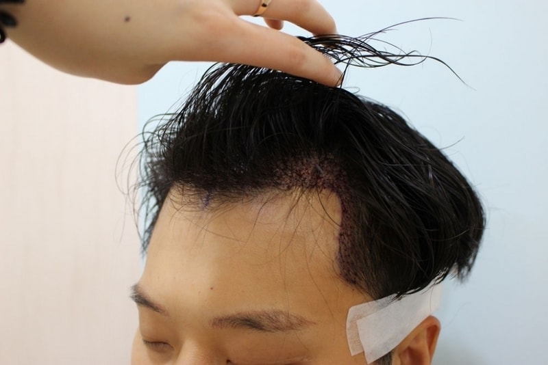 수술직후3.jpg