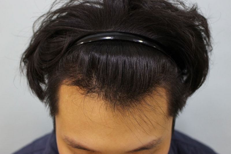 수술13일3.jpg
