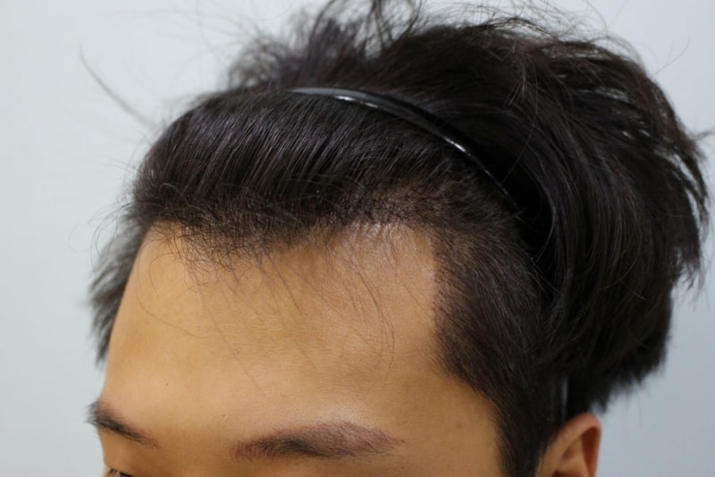 수술13일4.jpg