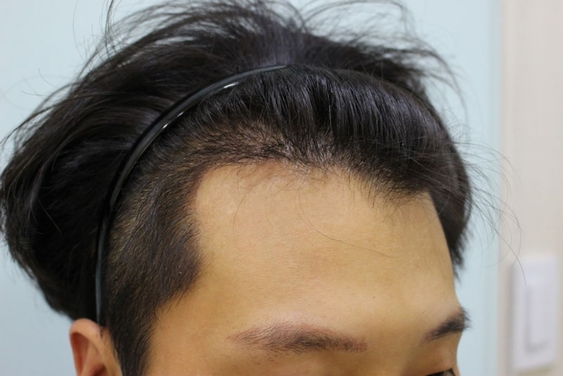 수술13일5.jpg
