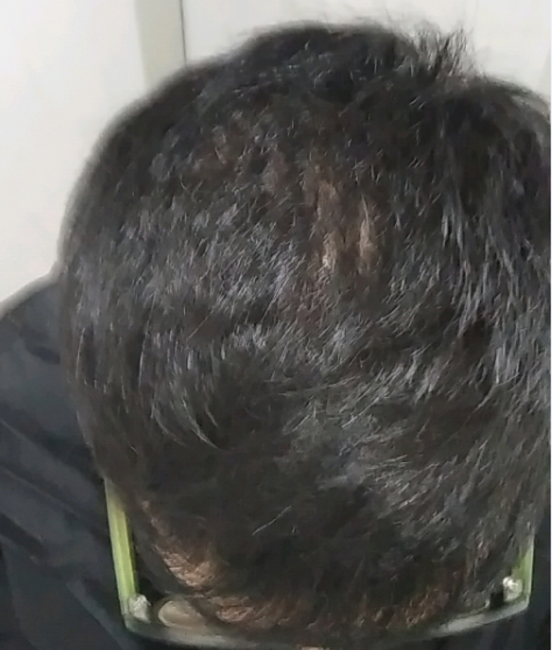 캡처4.PNG