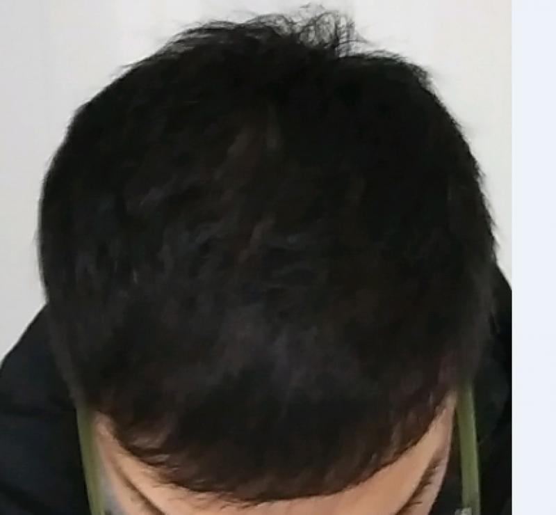 캡처3.PNG