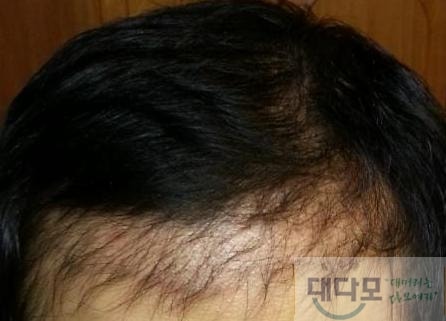 5개월.jpg