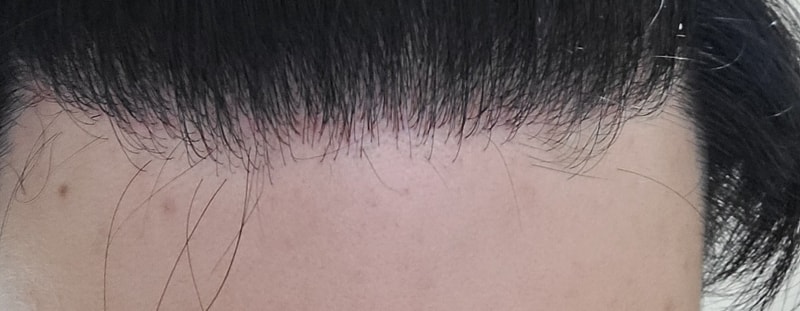 대가리1.jpg