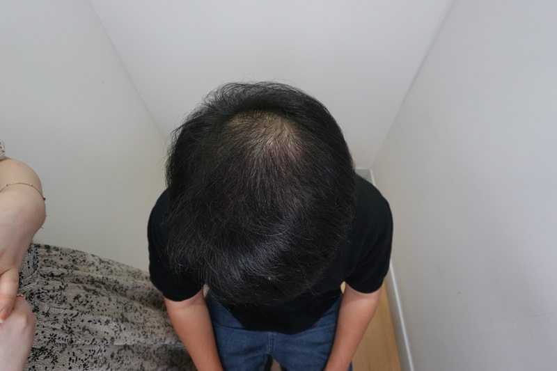 수술후 윗면.jpg