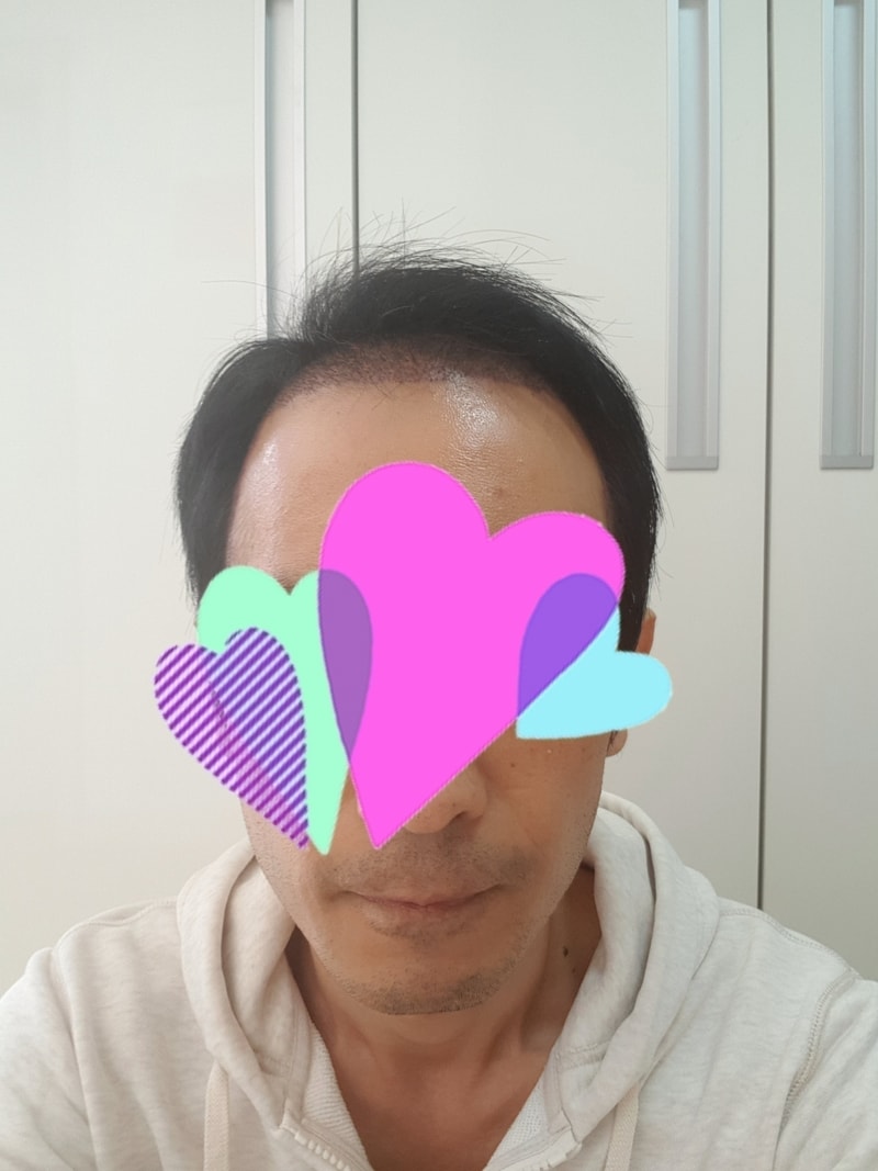 앞.jpg
