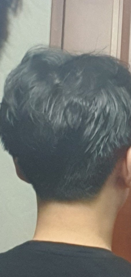 뒤통수 사진.jpg