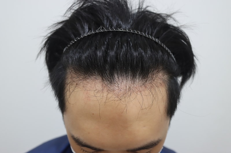 3개월차.jpg