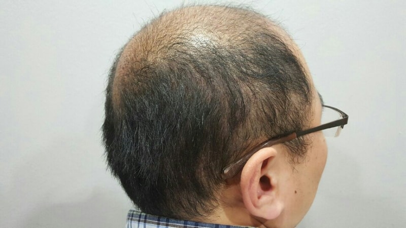 KakaoTalk_20170418_225901349.jpg