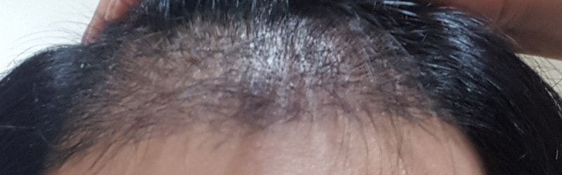 20180402_211512.jpg