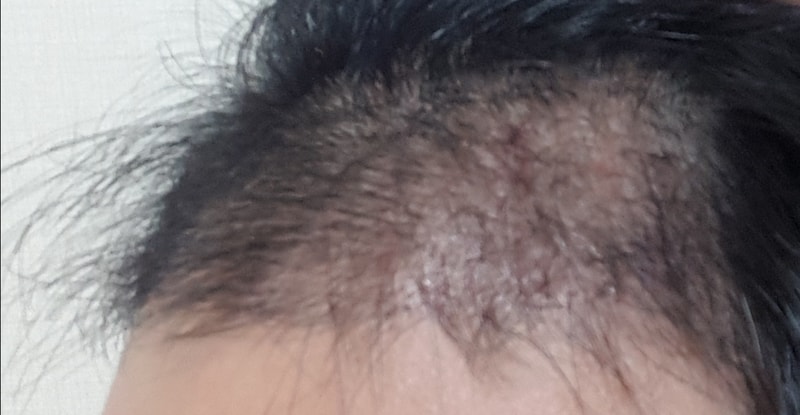 20180402_211451.jpg