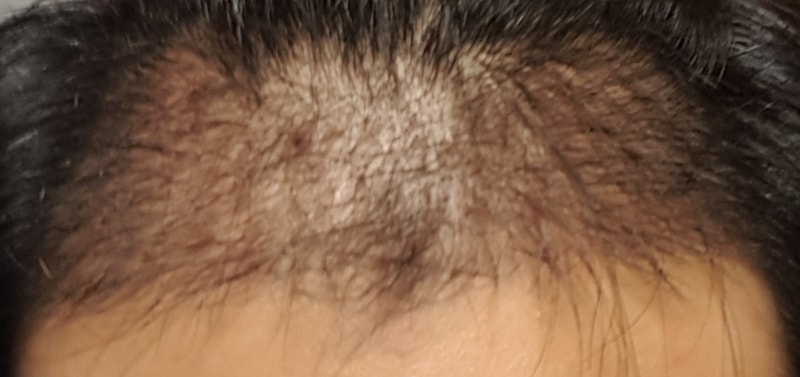 20180402_212312.jpg