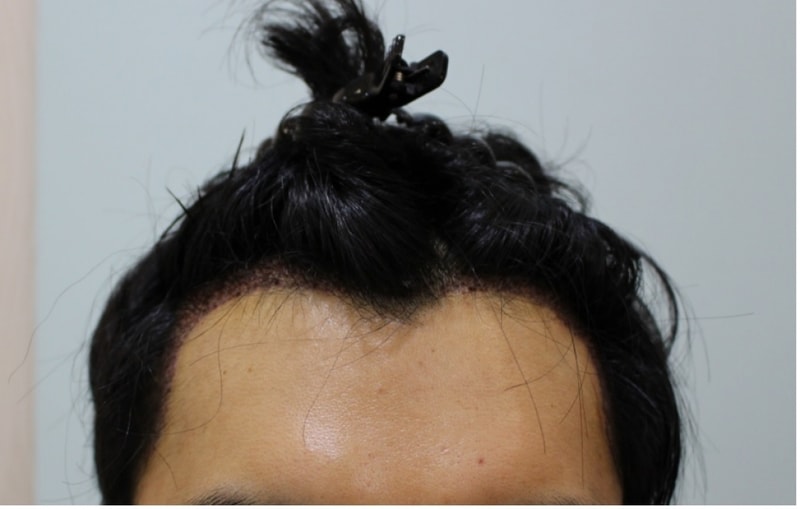 수술후3.jpg