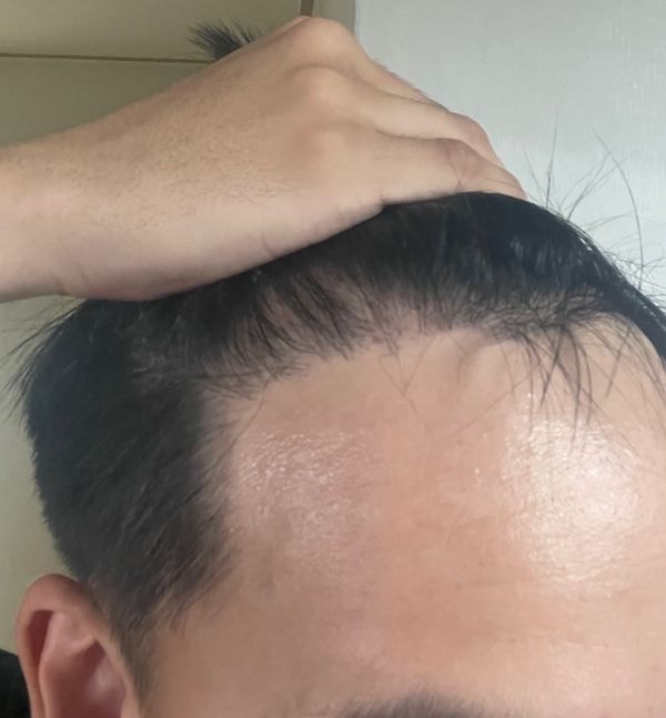 6개월_2.jpg