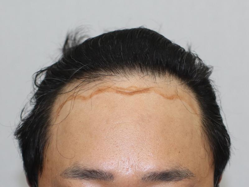 M 3500 비삭 9개월 후기