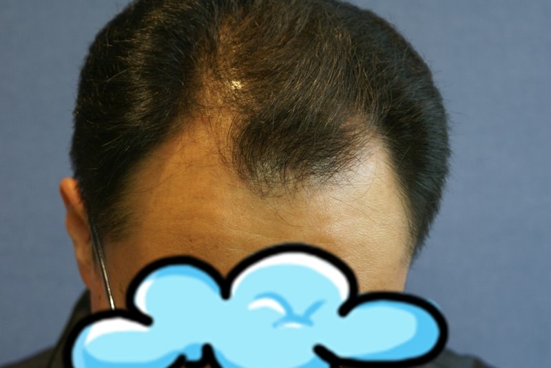 수술전.JPG