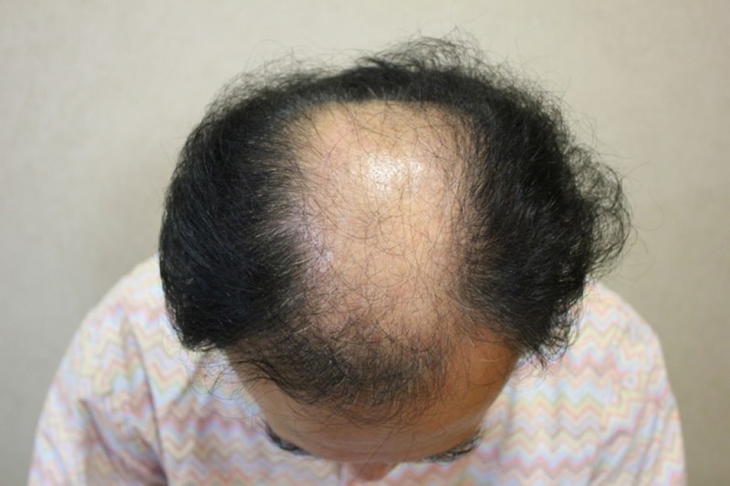 선택1.jpg