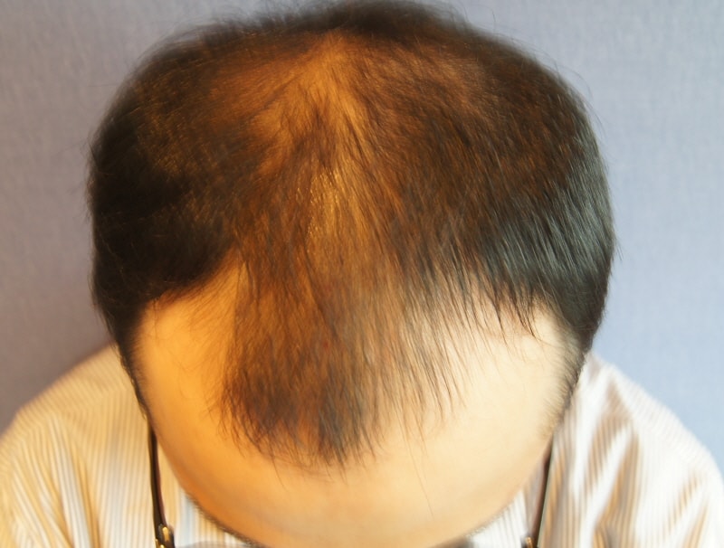 op_DSC02194.JPG