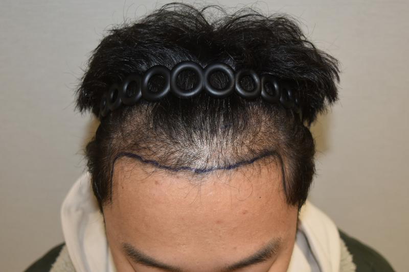 MODALL 4500MO 第一天后期