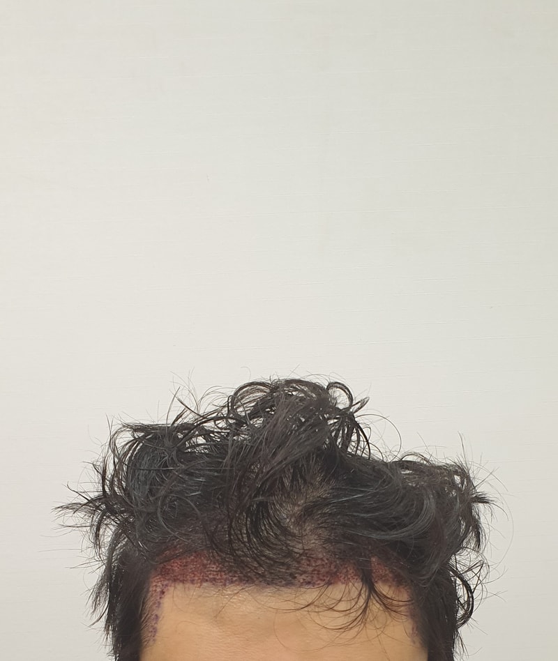 후.jpg