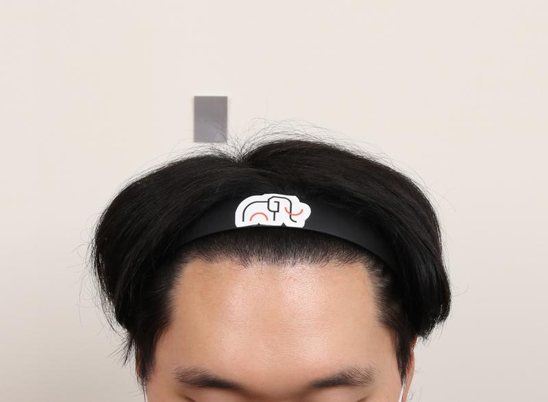 Busan Mammoth M-shaped hair transplant after 7 months