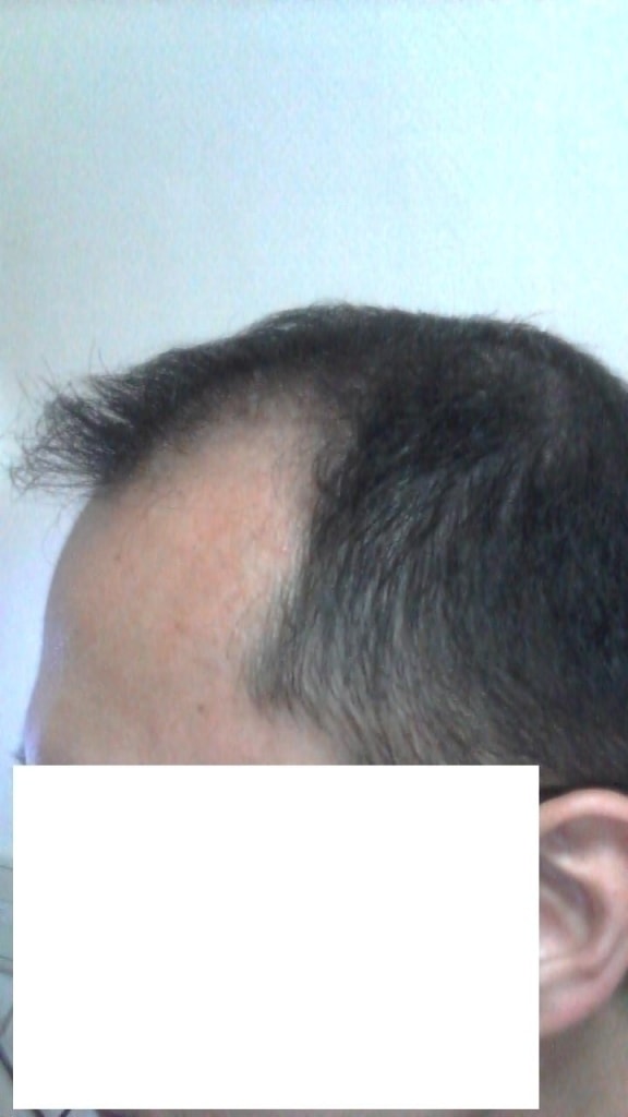옆모습.JPG