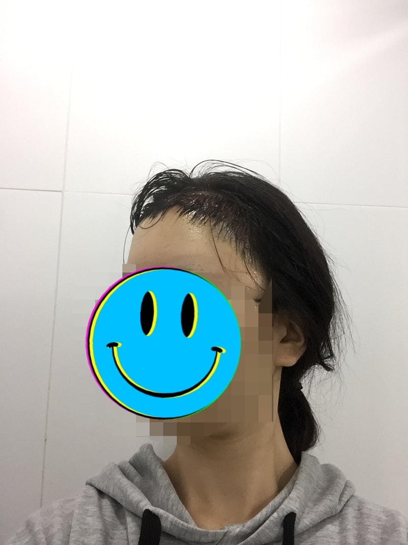 ニューヘアライン1日目です