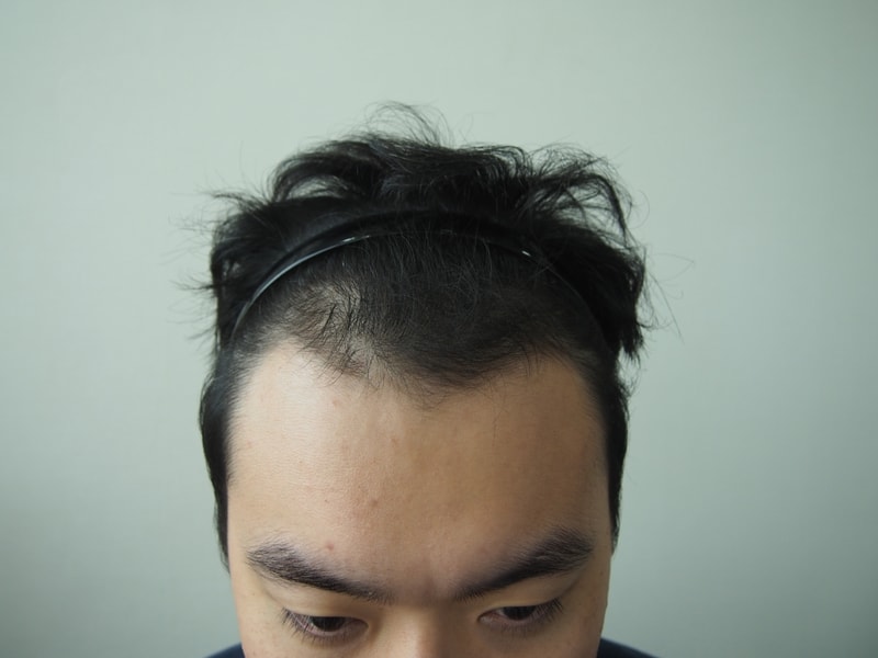 1146毛囊评价一个月