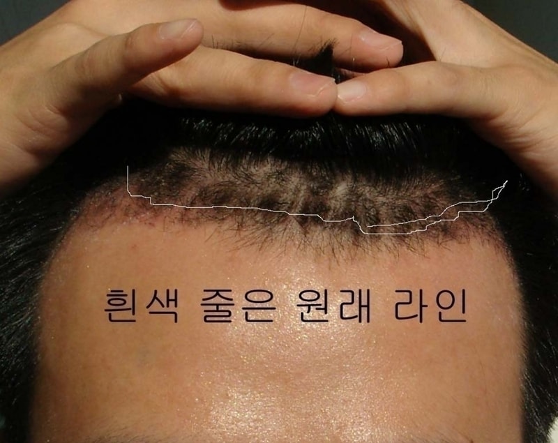 정면라인.jpg