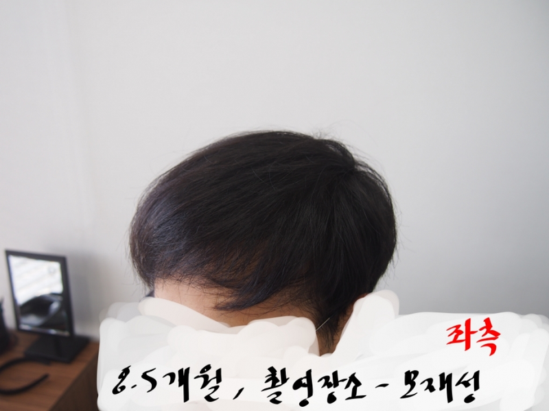 좌측.png