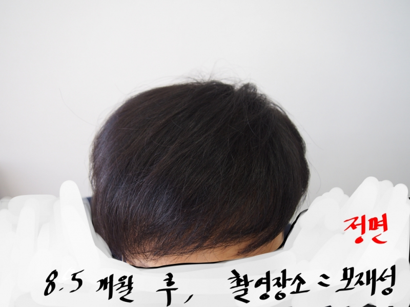 정면.png