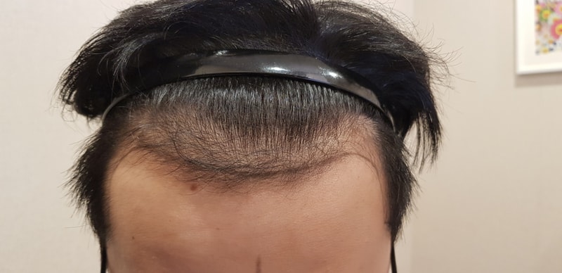 KakaoTalk_20180803_213617865.jpg
