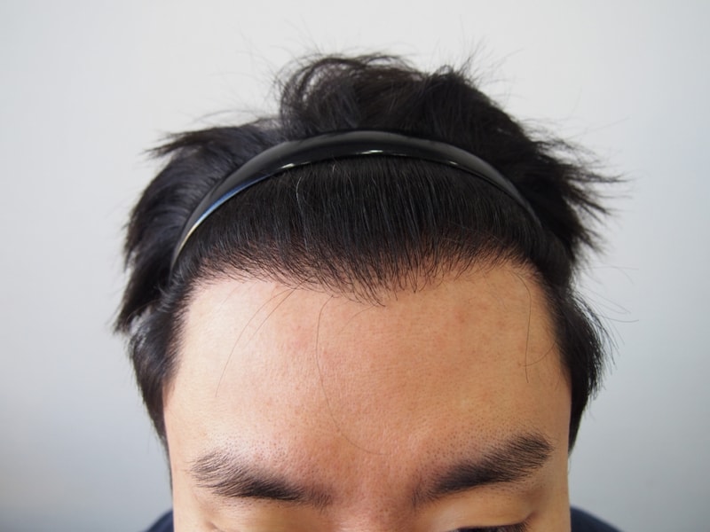 수술전1.JPG