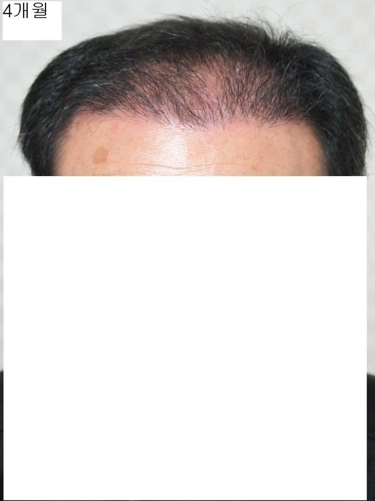4개월정면.JPG
