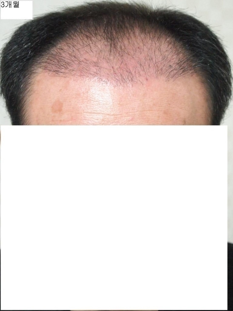3개월정면.JPG