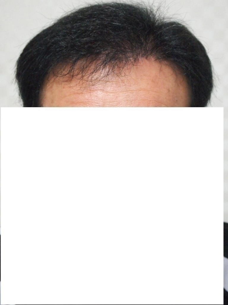 7개월째 앞.JPG