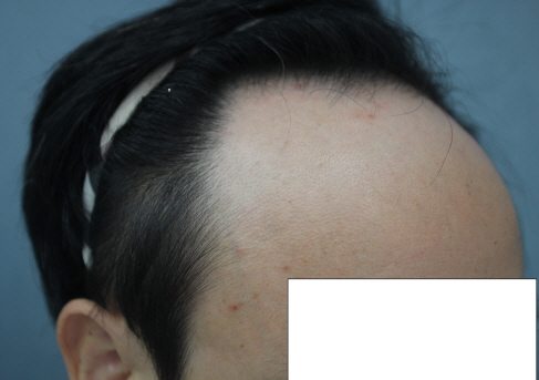 사본 -Before-2.jpg