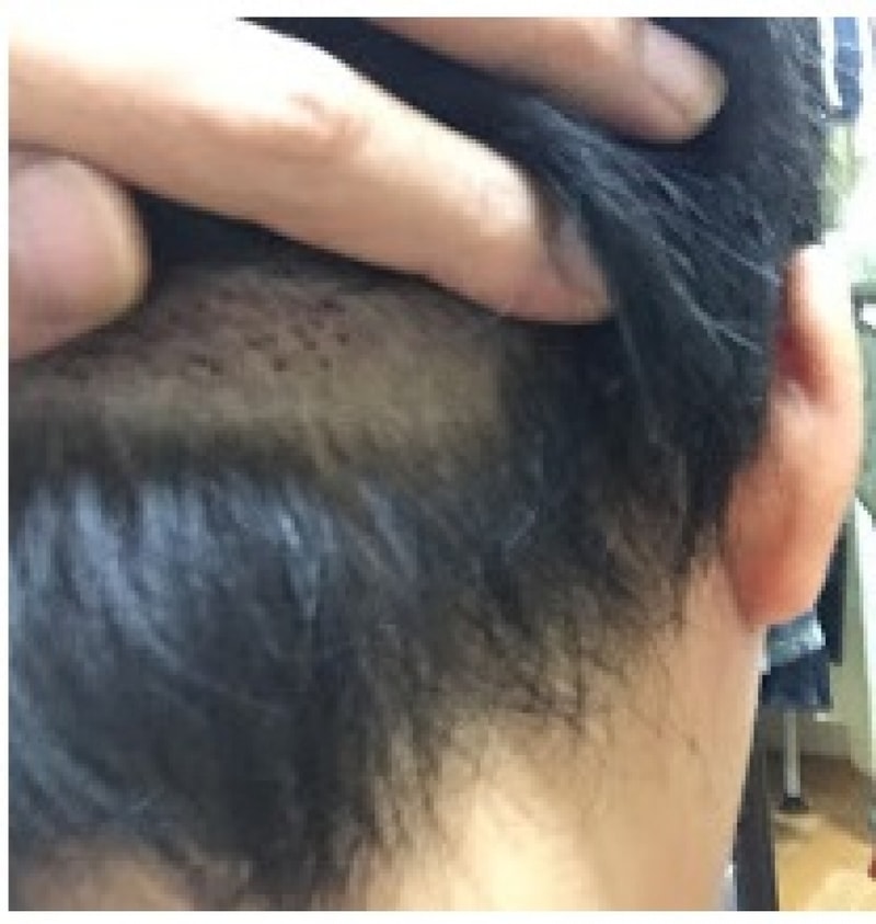 뒤통수1.jpg