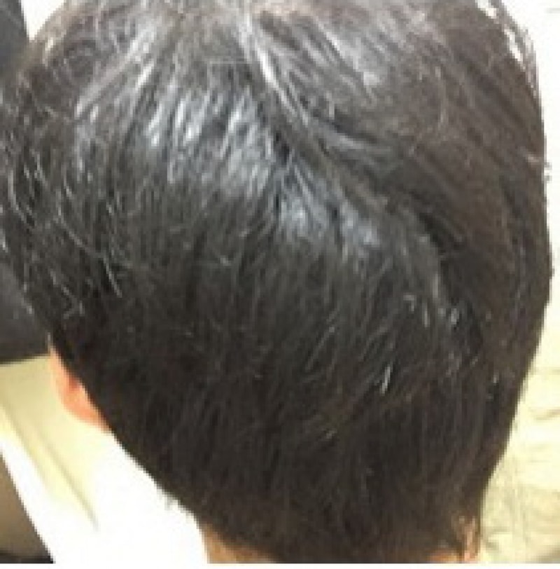 뒤통수0.jpg