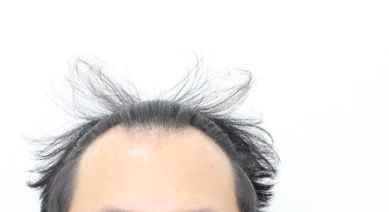 전중.jpg