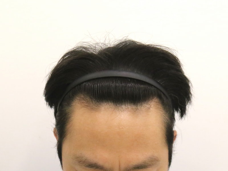 포토후기 이미지