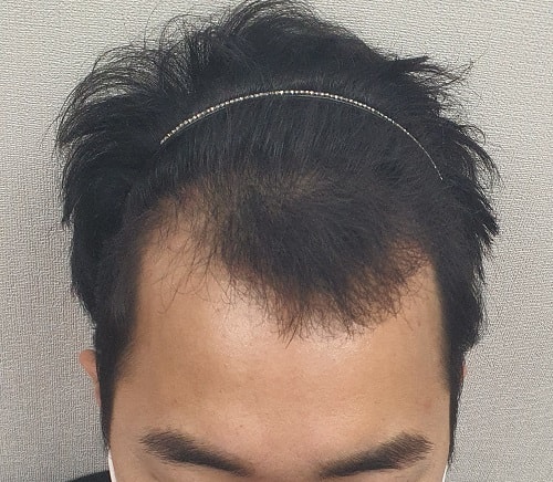 수술전1.jpg