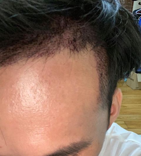 후1.jpg