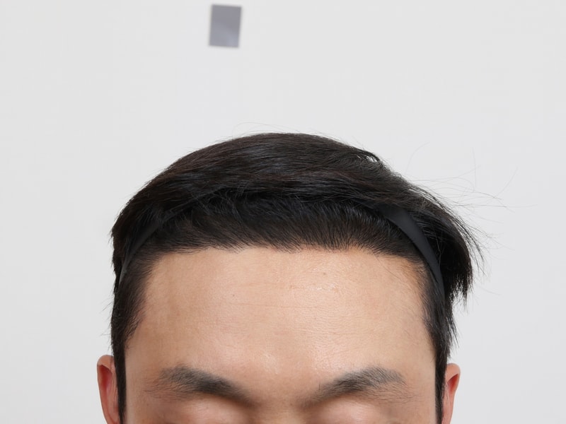 수술 경과 7개월.jpg