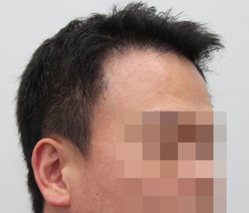 후2.jpg