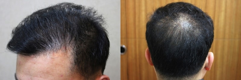 수술후(2).jpg