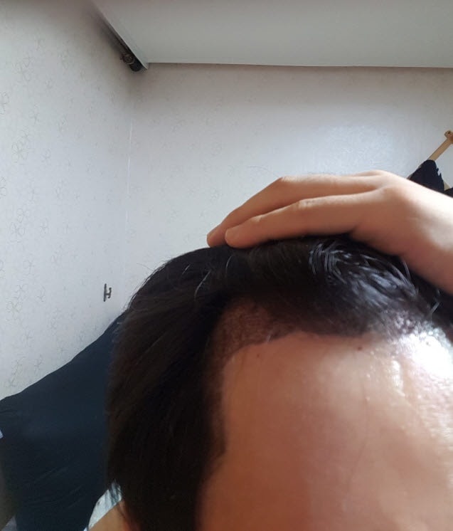 후2.jpg