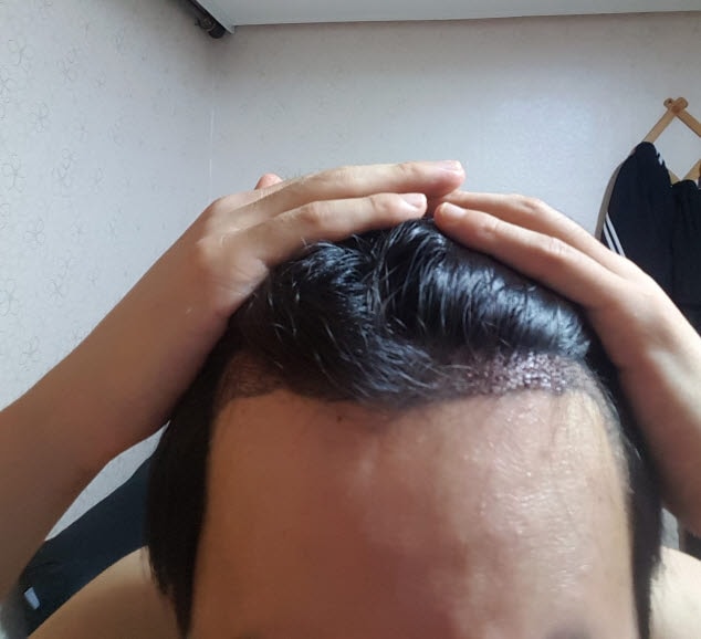 후1.jpg